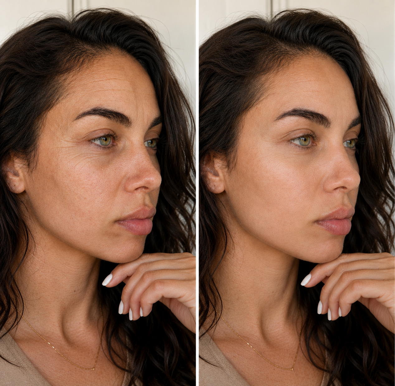 Anti-Rynk Silikontejp - Praktiskt alternativ till krämer och botox
